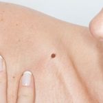 Bí ẩn về các vị trí ý nghĩa nốt ruồi son trên ngực, ở tay